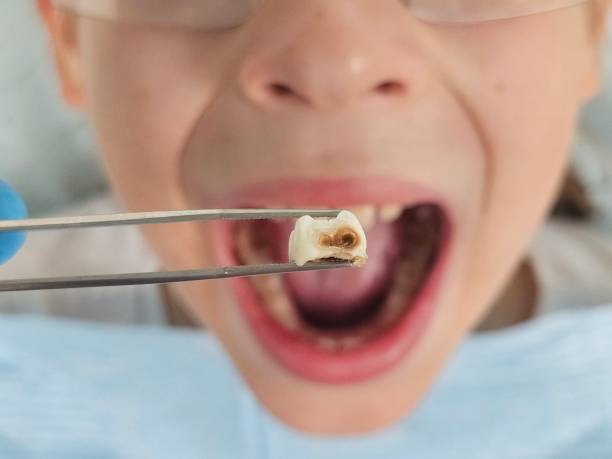 Best Tooth Pain Emergency Relief  in Nacogdoches, TX